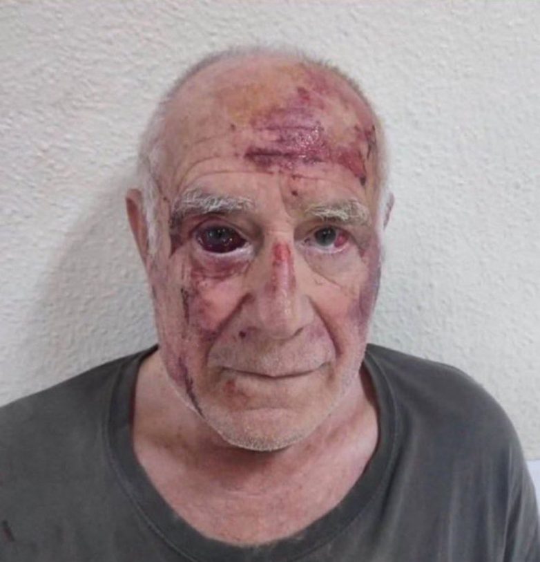 "Senior Beaten by Islamists: Where's Spain's Outrage for Citizens?" Islamist violence in Europe, Spanish government response to crime, safety of civilians in multicultural societies